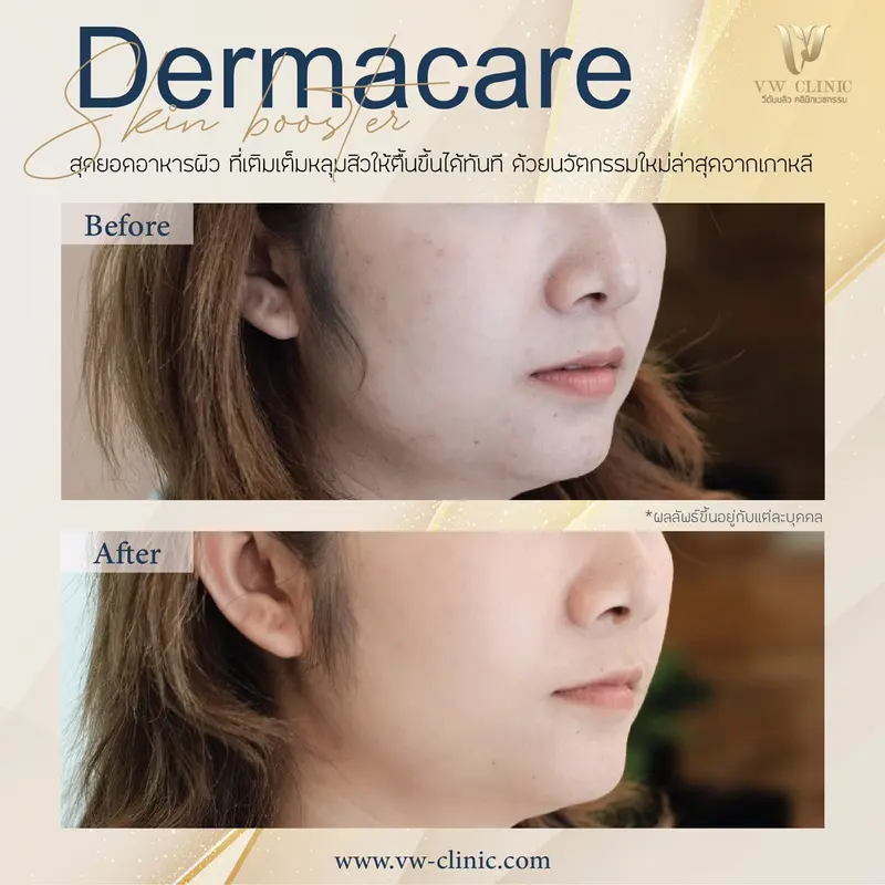 Dermacare