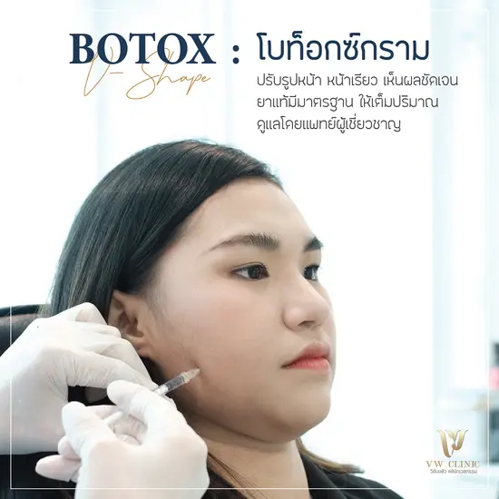 Botox กราม