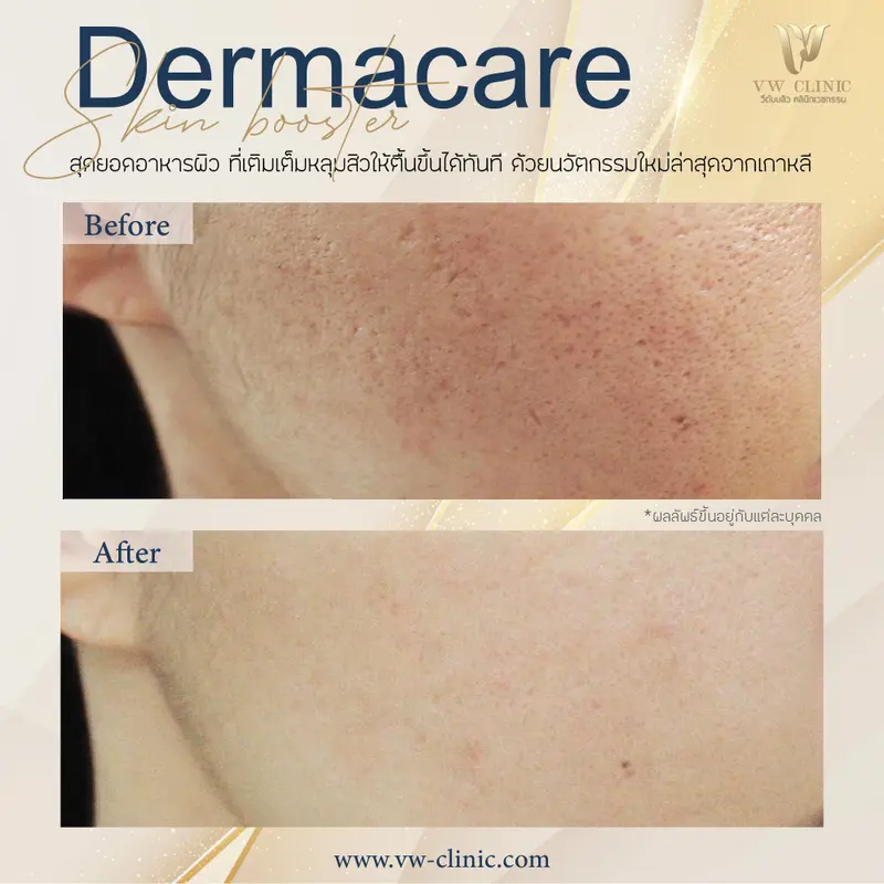 Dermacare