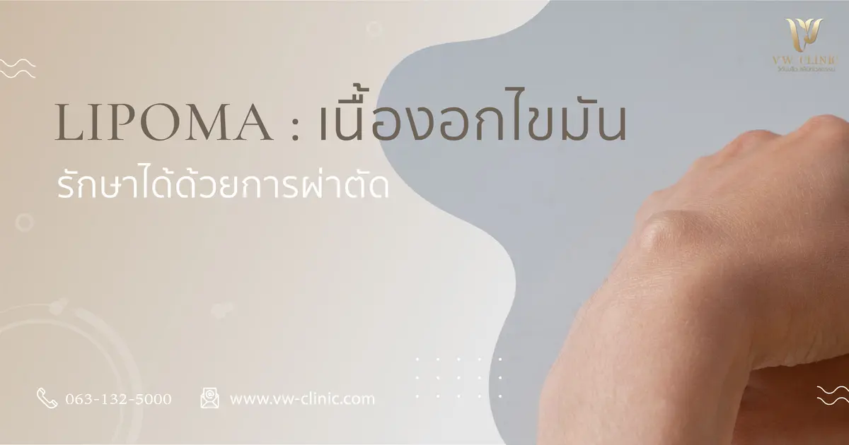 Lipoma เนื้องอกไขมัน รักษาได้โดยการผ่าตัด