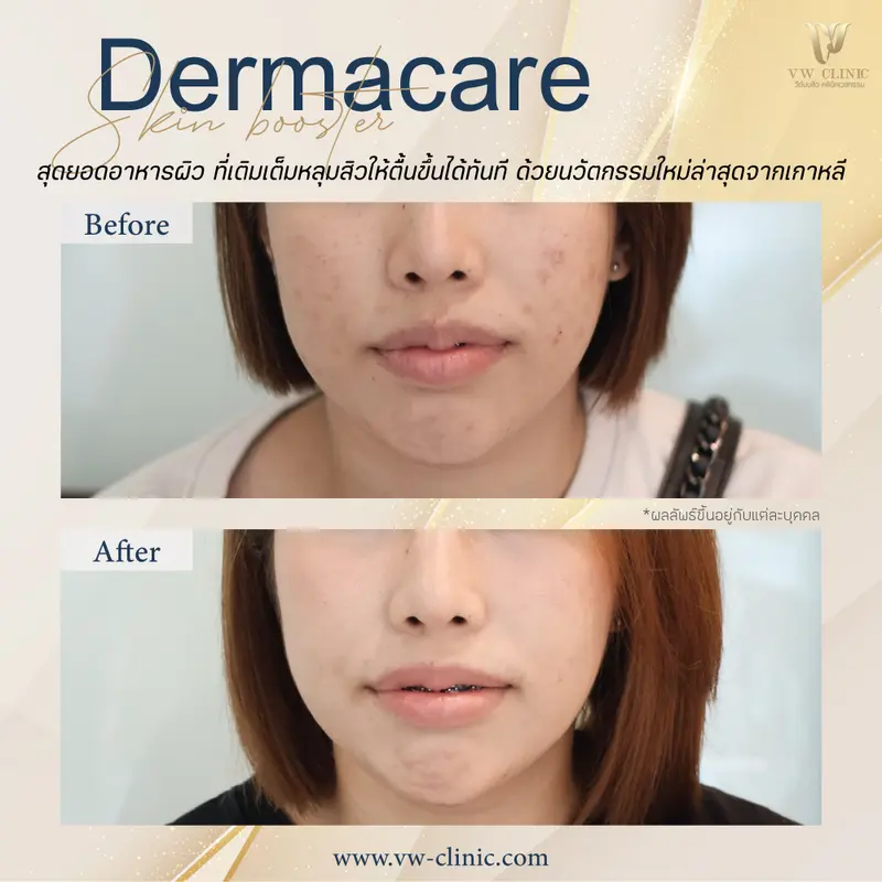 Dermacare