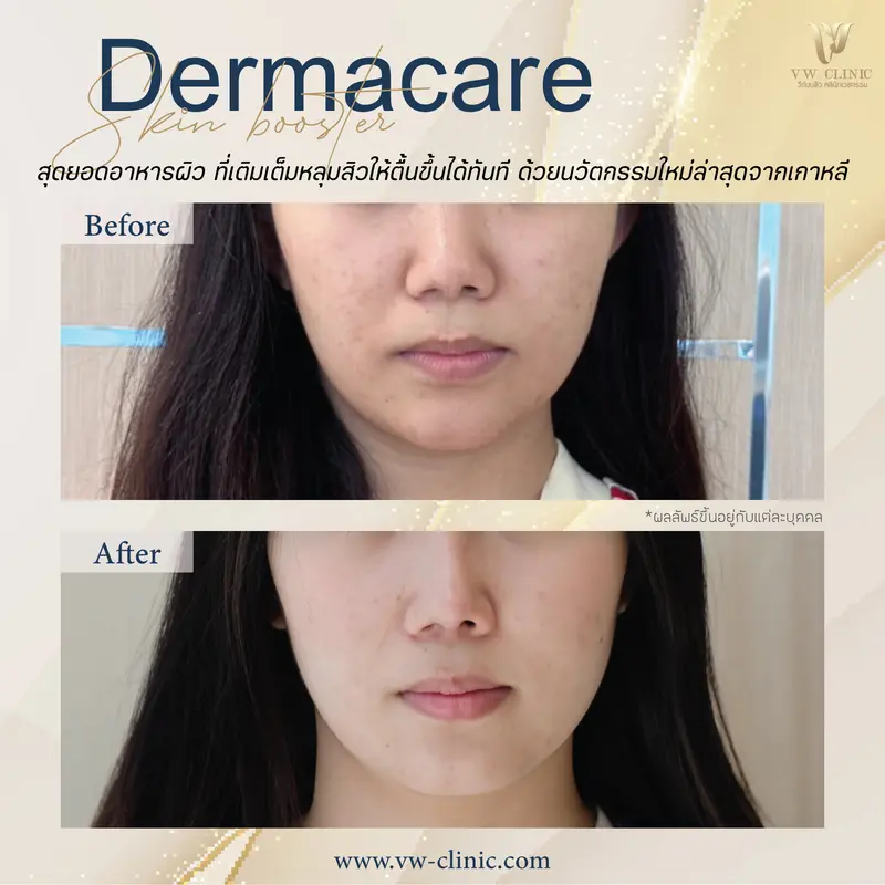 Dermacare