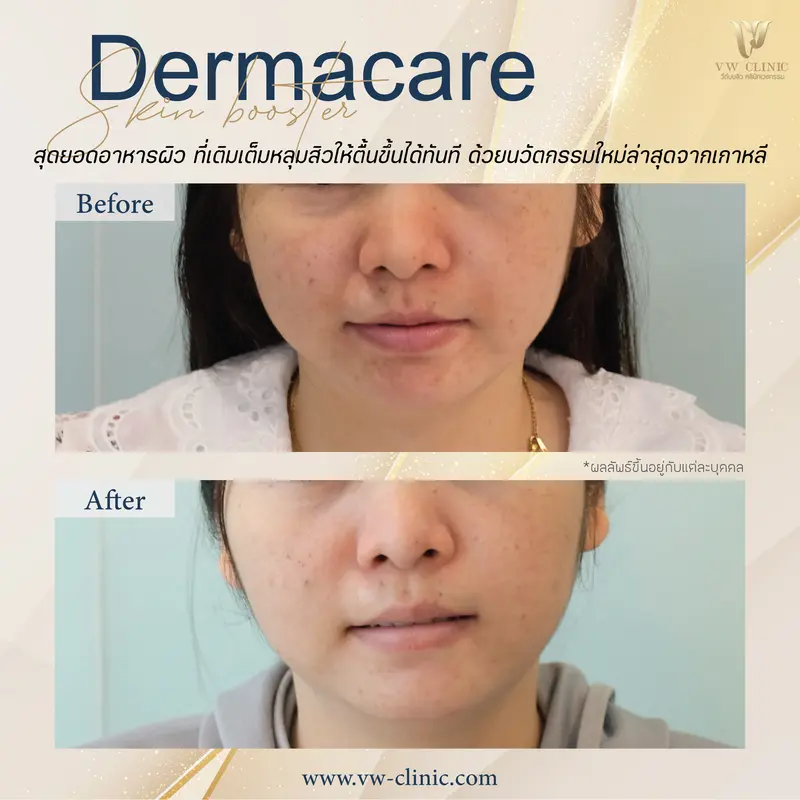 Dermacare