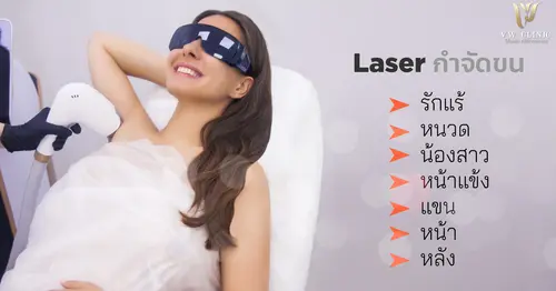 เลเซอร์ขน (Laser) มีวิธีกำจัดแบบไหนได้บ้าง?