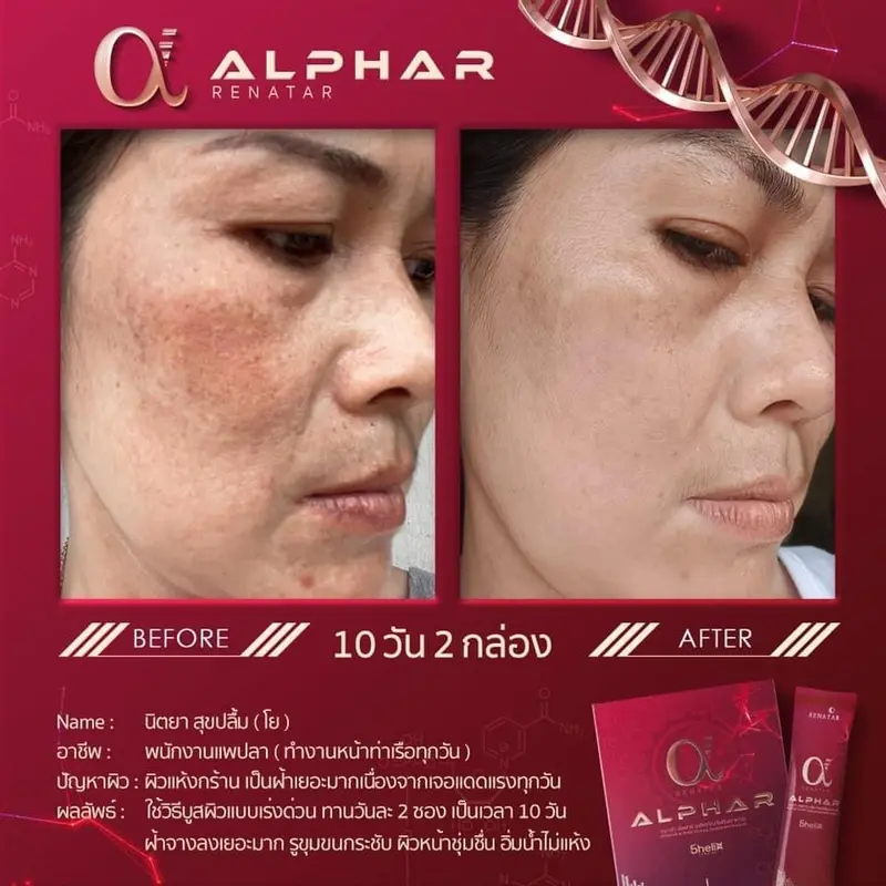 รีวิวก่อนและหลังทาน Renatar Alphar