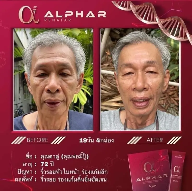 รีวิวก่อนและหลังทาน Renatar Alphar