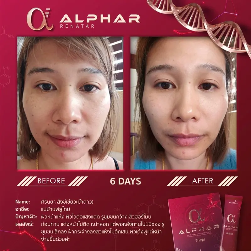 รีวิวก่อนและหลังทาน Renatar Alphar