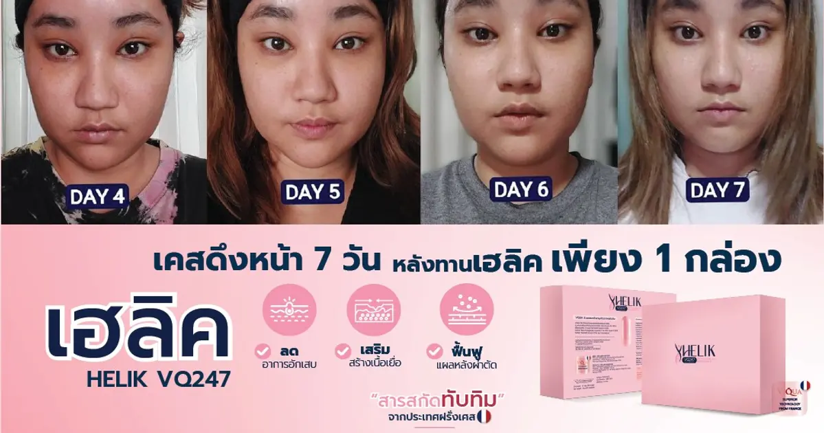 เคสดึงหน้า 7 วัน ความช้ำไหนคะ ?