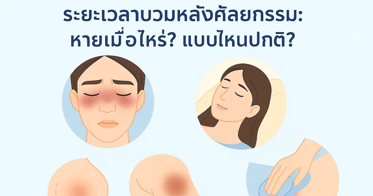 ระยะเวลาบวมหลังศัลยกรรม: หายเมื่อไหร่? แบบไหนปกติ?