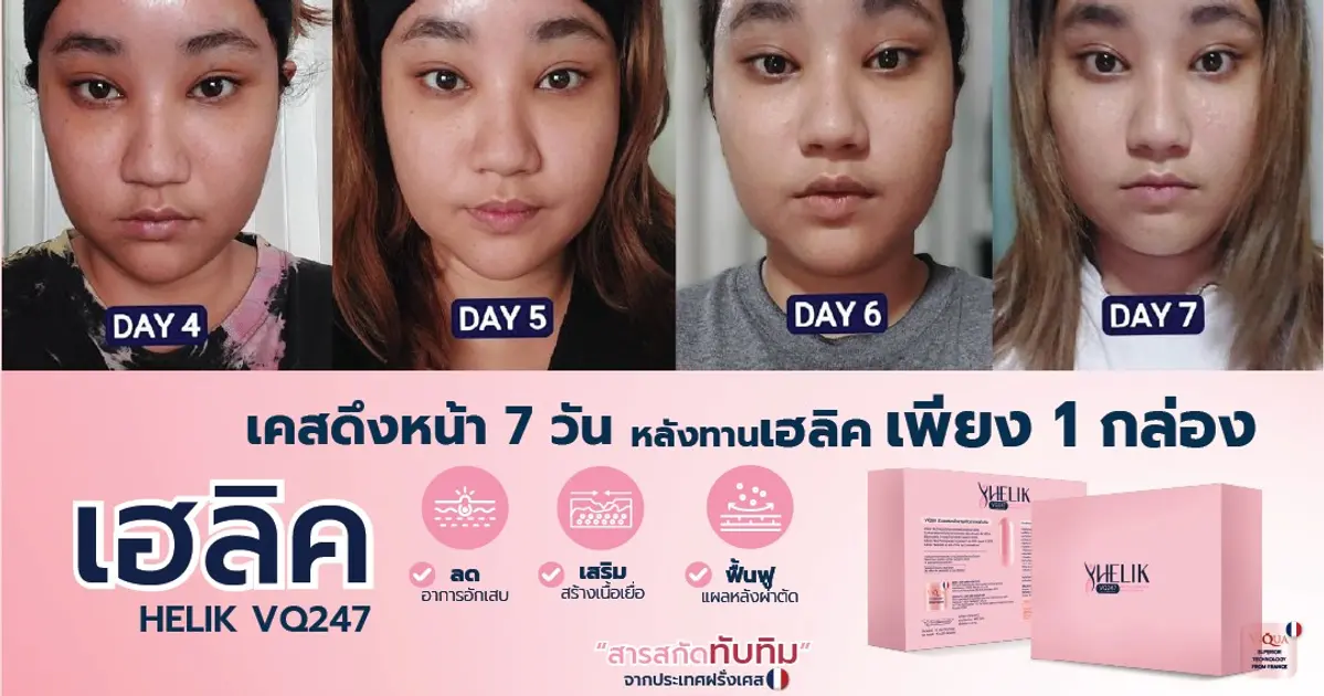 รีวิวผลลัพธ์หลังยกคิ้ว 7 วัน ด้วยตัวช่วยฟื้นฟู Helik VQ247