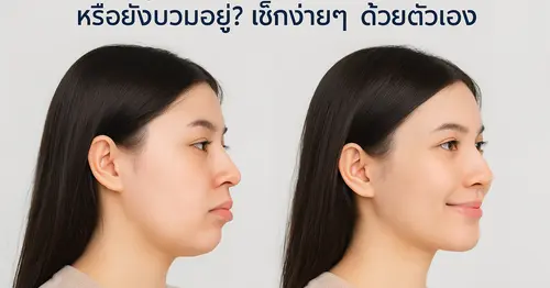 วิธีดูว่า ‘คางเข้าที่แล้ว’ หรือยังบวมอยู่? เช็กง่ายๆ ด้วยตัวเอง