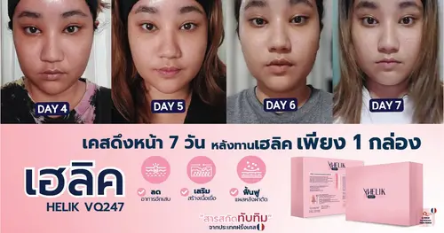 รีวิวผลลัพธ์หลังยกคิ้ว 7 วัน ด้วยตัวช่วยฟื้นฟู Helik VQ247