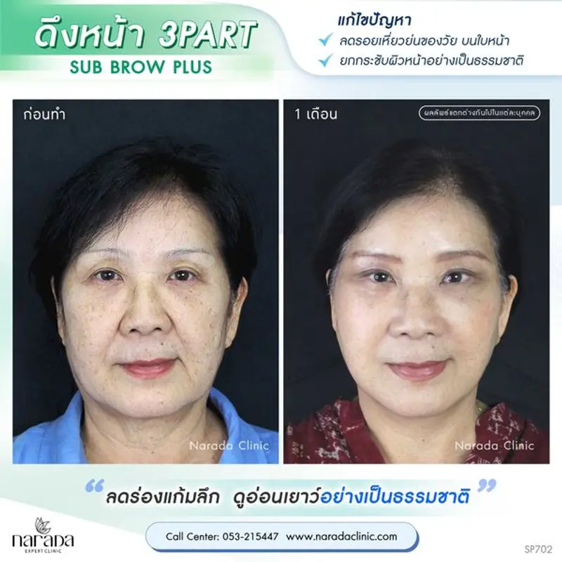 ดึงหน้า 3 พาร์ท