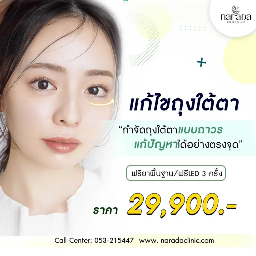 แก้ไขถุงใต้ตา ที่ นารดาคลินิก