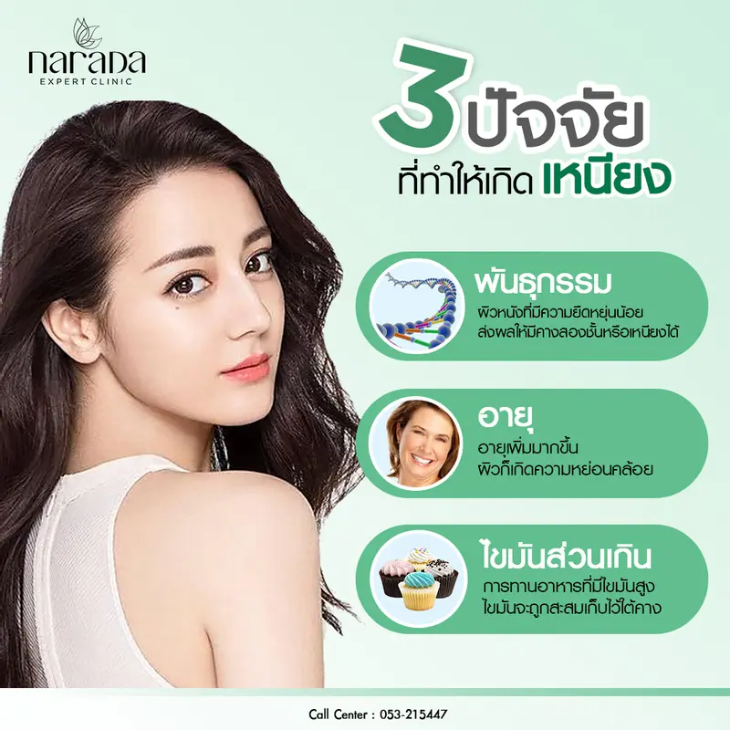 3 ปัจจัยหลักที่ทำให้เกิดเหนียง ปัญหาอันดับต้นๆ ของหนุ่ม สาวในทุกอายุ ที่ นารดาคลินิก