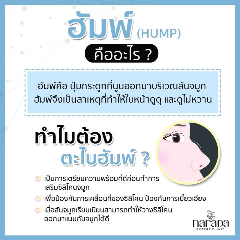 ฮัมพ์คืออะไร? ทำไมต้องตะไบ? วันนี้นารดาคลินิกมีความรู้เรื่อง ฮัมพ์และการตะไบฮัมพ์มาฝากกันค่ะ .
