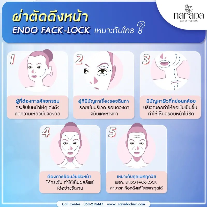 ผ่าตัดดึงหน้า เหมาะกับใคร ?  ด้วยเทคนิค Endo Fack-Lock #นารดาคลินิก