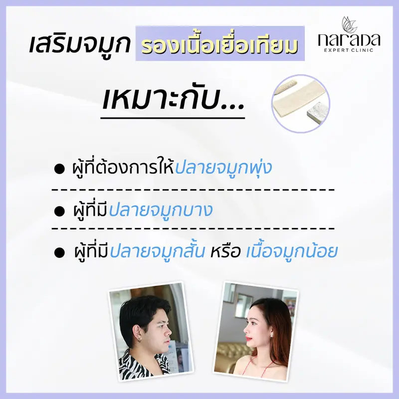 เสริมจมูก รองเนื้อเยื่อเทียมเป็นอย่างไร นารดาคลินิกมีคำตอบ