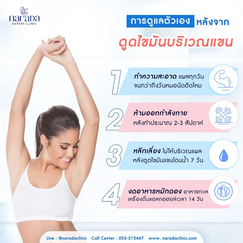 หลังจากดูดไขมันบริเวณแขน ต้องปฏิบัติตัวอย่างไรบ้าง?