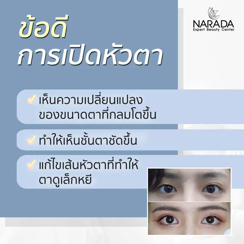 การเปิดหัวตาคืออะไร?