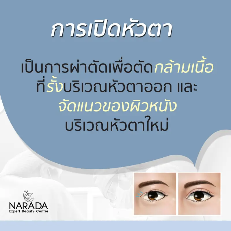 การเปิดหัวตา