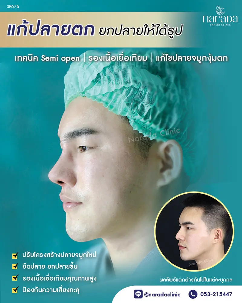 เปลี่ยนทรงใหม่ ให้หล่อกว่าเดิม ที่ นารดาคลินิก