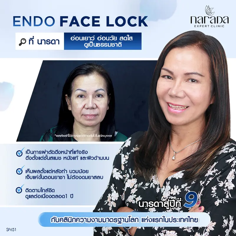 ล็อคความสวย ที่ นารดาคลินิก