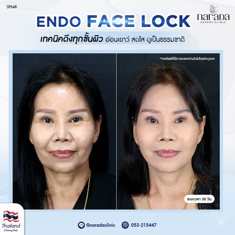 ถึงจะอยู่ไกล แต่ถูกใจ นารดาคลินิก