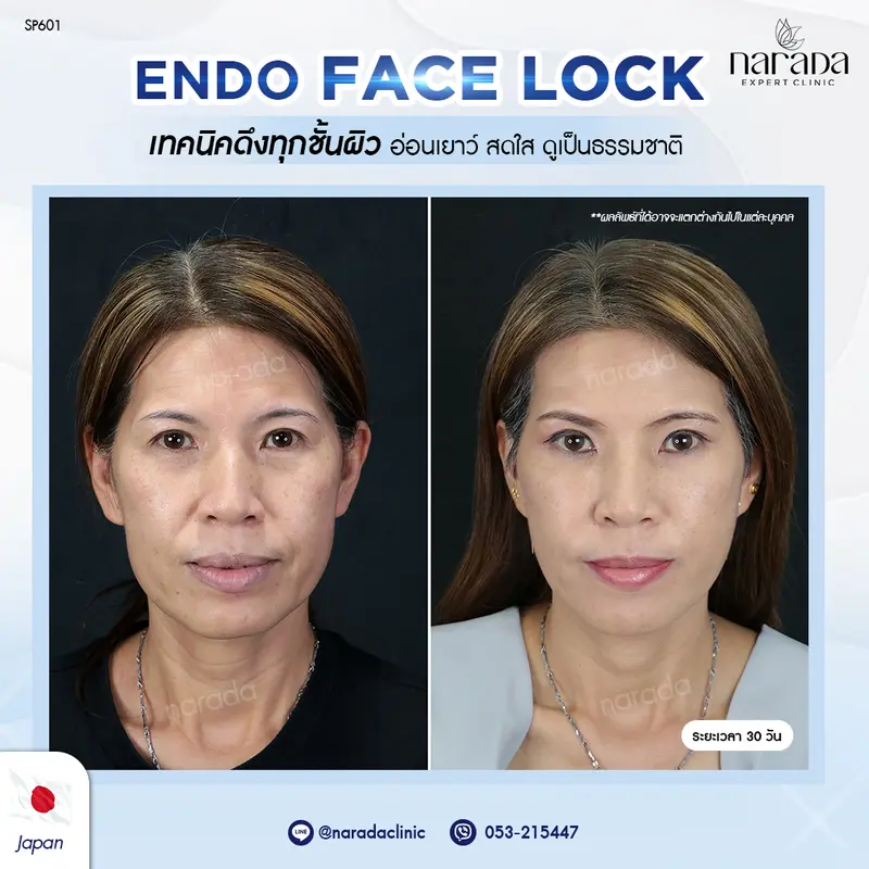 ถึงจะอยู่ไกล แต่ถูกใจ นารดาคลินิก