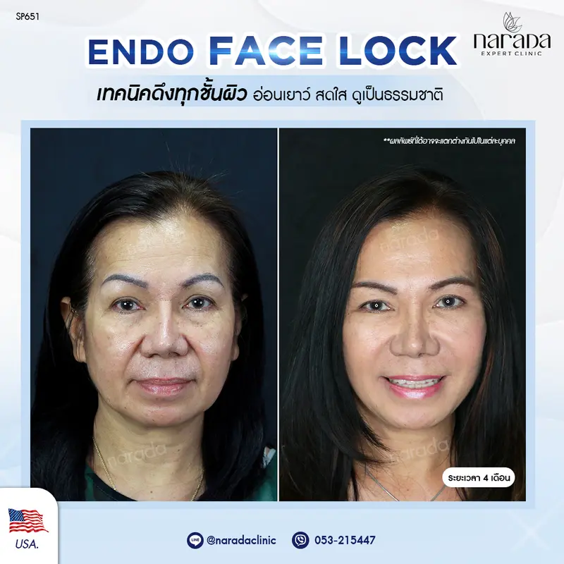 ถึงจะอยู่ไกล แต่ถูกใจ นารดาคลินิก