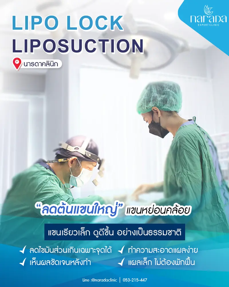 ลดต้นแขน แขนเรียวเล็ก ที่ นารดาคลินิก