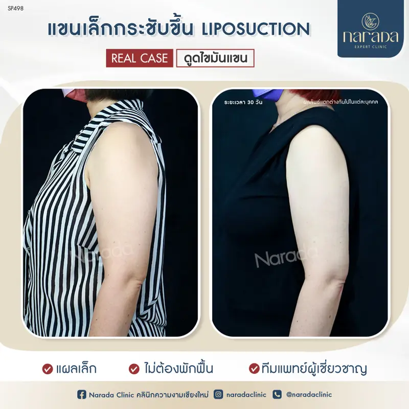 ยกแขนอย่างมั่นใจ ที่ นารดาคลินิก