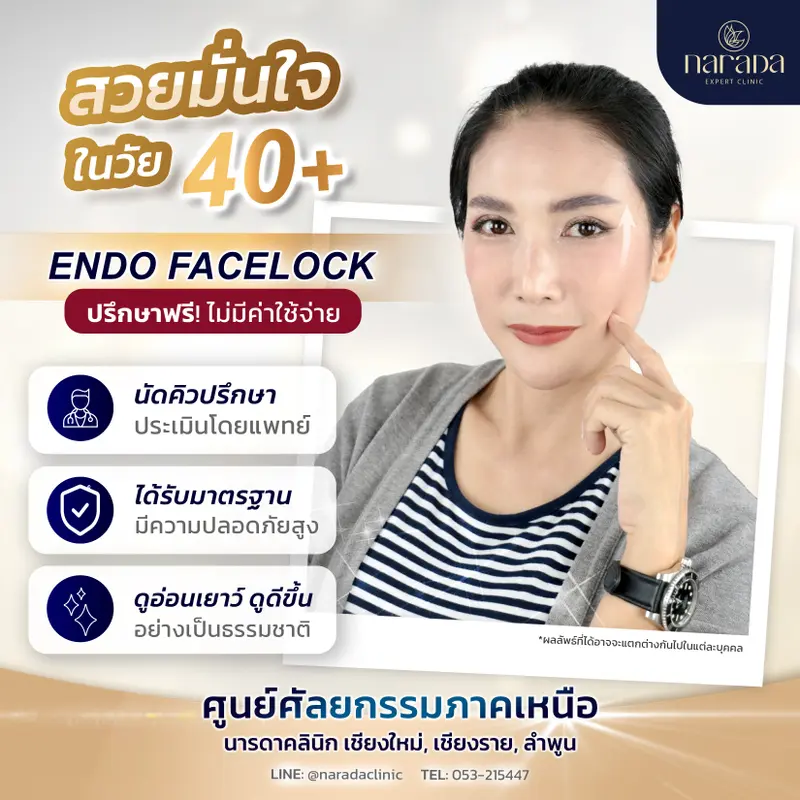เพิ่มสวยอย่างมั่นใจ ในวัย 40+ ENDO - FACELOCK #นารดาคลินิก