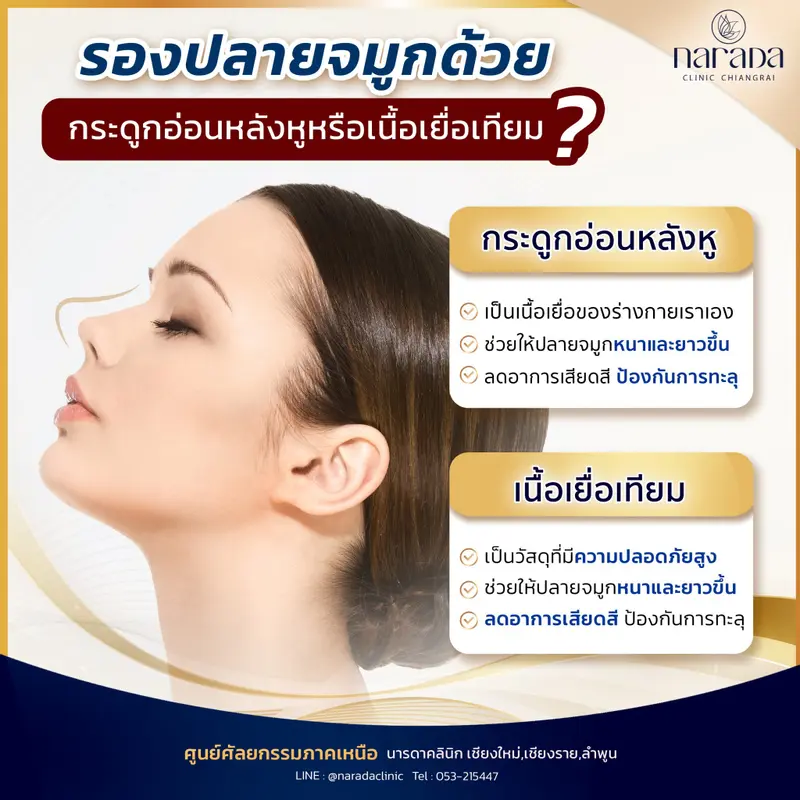 เสริมจมูก รองปลายจมูก ด้วยกระดูกอ่อนหลังหูหรือเนื้อเยื่อเทียมดี?