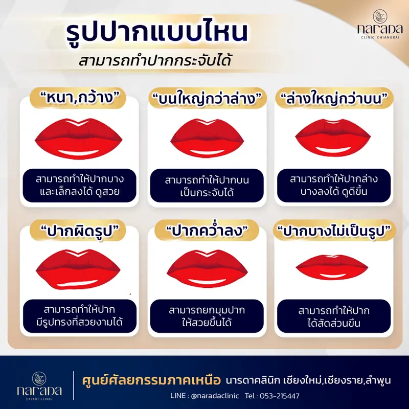 รูปปากแบบไหน สามารถทำปากกระจับได้
