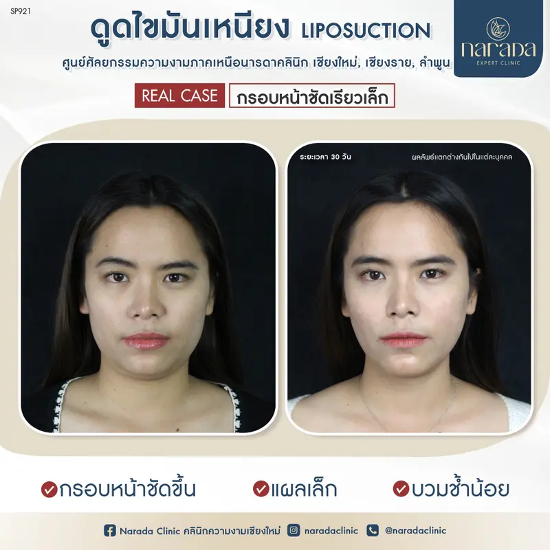 🌷🌷บอกลาเหนียง ที่อยู่กับเรามานาน🌷🌷