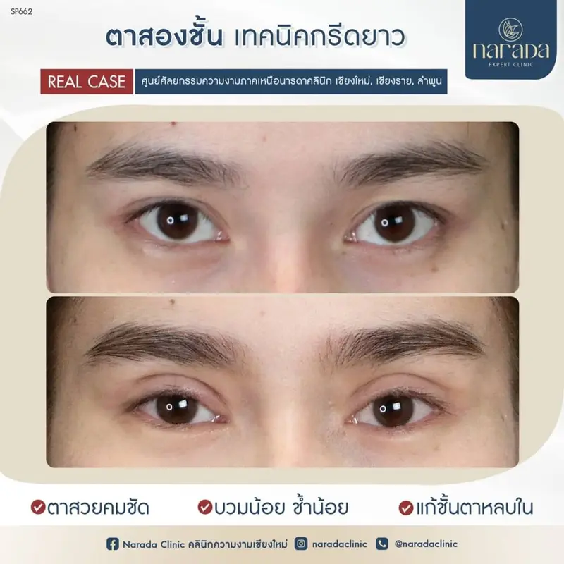 เปลี่ยนสายตาธรรมดา ให้เป็นสายตาที่ดึงดูด