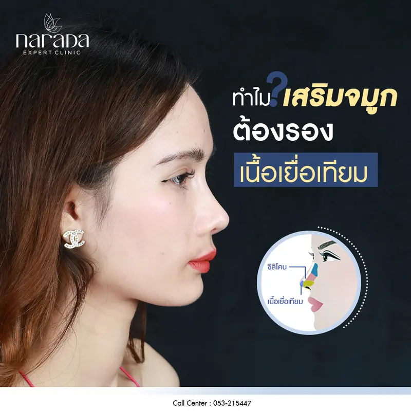 🌈✨ยืดปลายจมูก ปรับทรงจมูกสโลปสวย ที่ นารดาคลินิก🌈✨