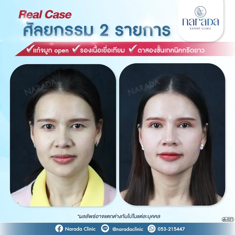 เปลี่ยนลุคสาวหน้าดุ ให้เป็นสาวสวยหน้าหวานละมุน