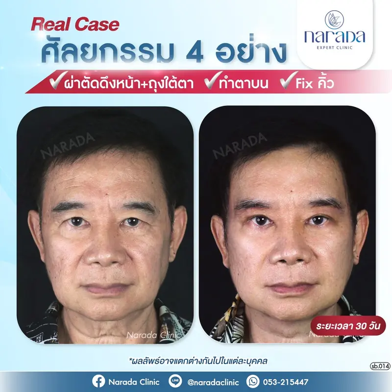 ไม่ว่าจะวัยไหน เพศไหนก็สามารถมาเพิ่มความมั่นใจ