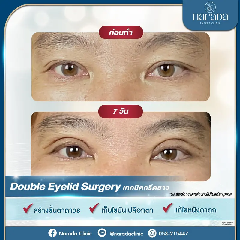 ✨มาเพิ่มเสน่ห์ให้กับดวงตา ให้คมชัดและสดใส✨