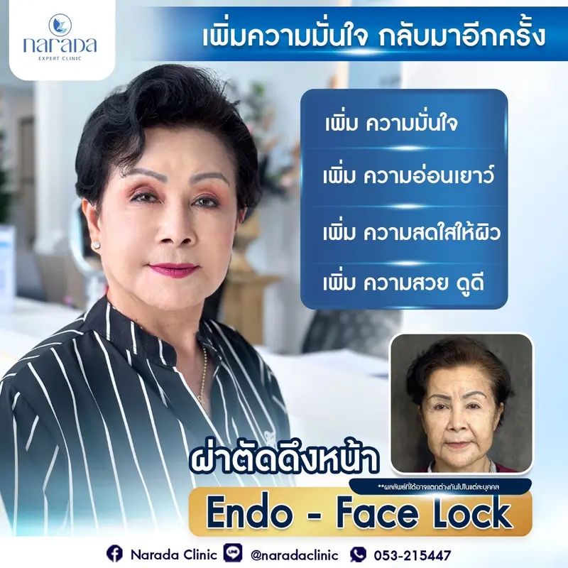 ✨เพิ่มความมั่นใจ กลับมาอีกครั้ง ด้วยการผ่าตัดดึงหน้าลดอายุให้ดูอ่อนกว่าวัย Endo-Face Lock 