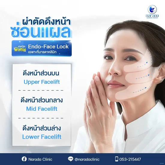 ดึงหน้าย้อนวัยด้วยเทคนิค Endo-Face Lock ยกกระชับใบหน้าเฉพาะทางจากนารดาคลินิก ดึงหน้าย้อนวัยด้วยเทคนิค Endo-Face Lock ยกกระชับใบหน้าเฉพาะทางจากนารดาคลินิก