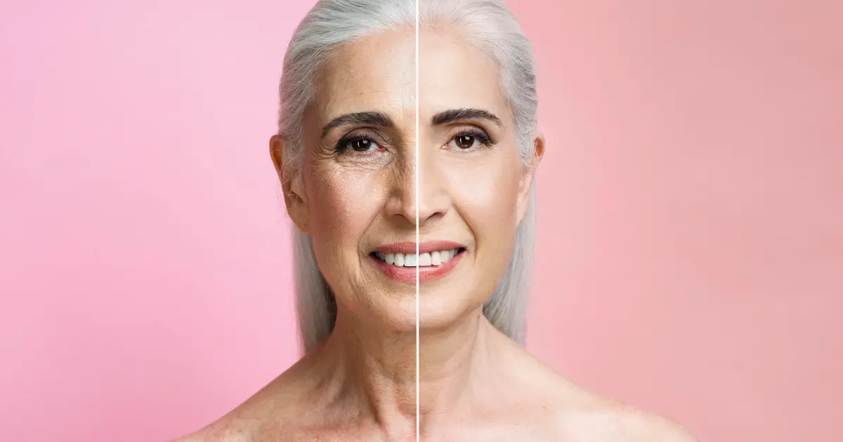 เจาะลึกราคา ‘ดึงหน้าย้อนวัย’ แต่ละเทคนิค แตกต่างกันอย่างไร?