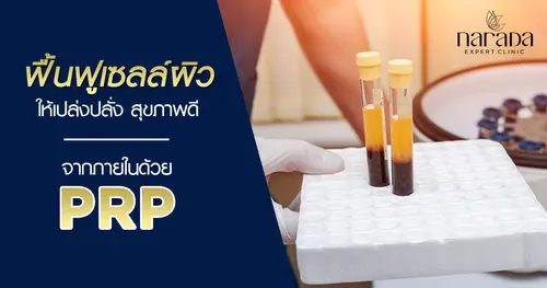 ฟื้นฟูเซลล์ผิวให้เปล่งปลั่งสุขภาพดีจากภายในด้วยเกล็ดเลือดของตัวเอง โดย PRP (Platelet Rich Plastma)