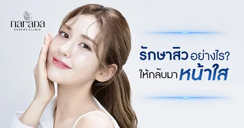 รักษาสิวอย่างไรให้กลับมาหน้าใสอีกครั้ง?