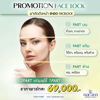 หน้าดูเด็ก ย้อนวัย ด้วยการดึงหน้า เทคนิค Endo-Facelock นารดาคลินิก