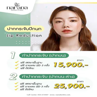ปากกระจับปีกนก Lip Reduction