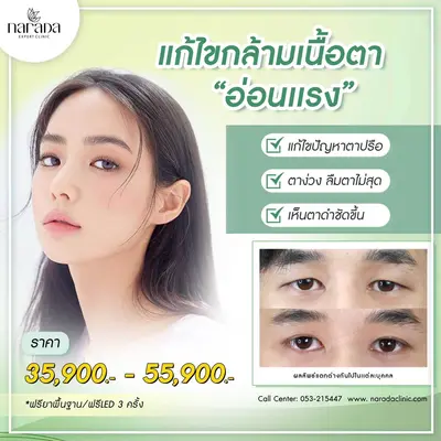 แก้ไขกล้ามเนื้อตา "อ่อนแรง"