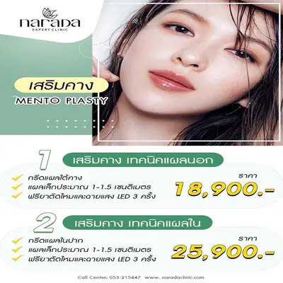 เสริมคาง Mento Plasty